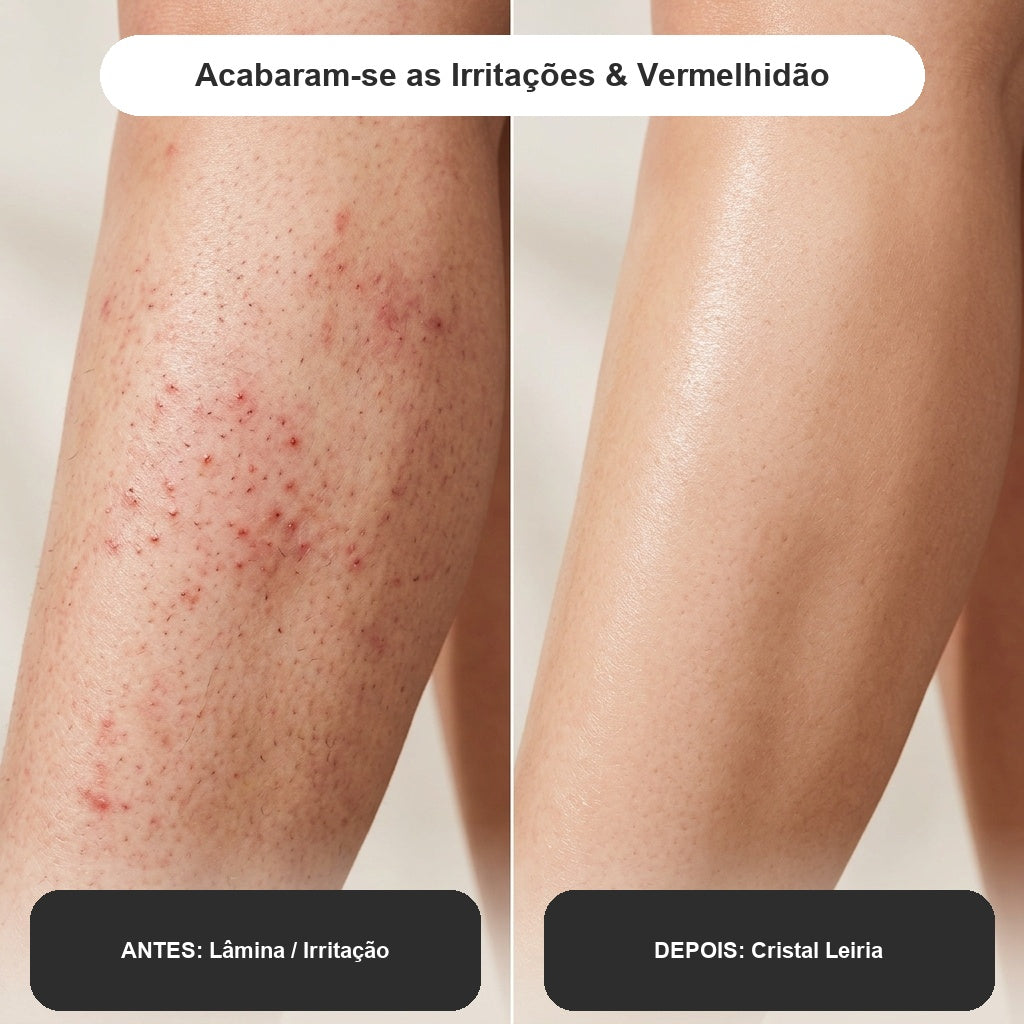 Ema | Aparador íntimo e corporal de alta precisão