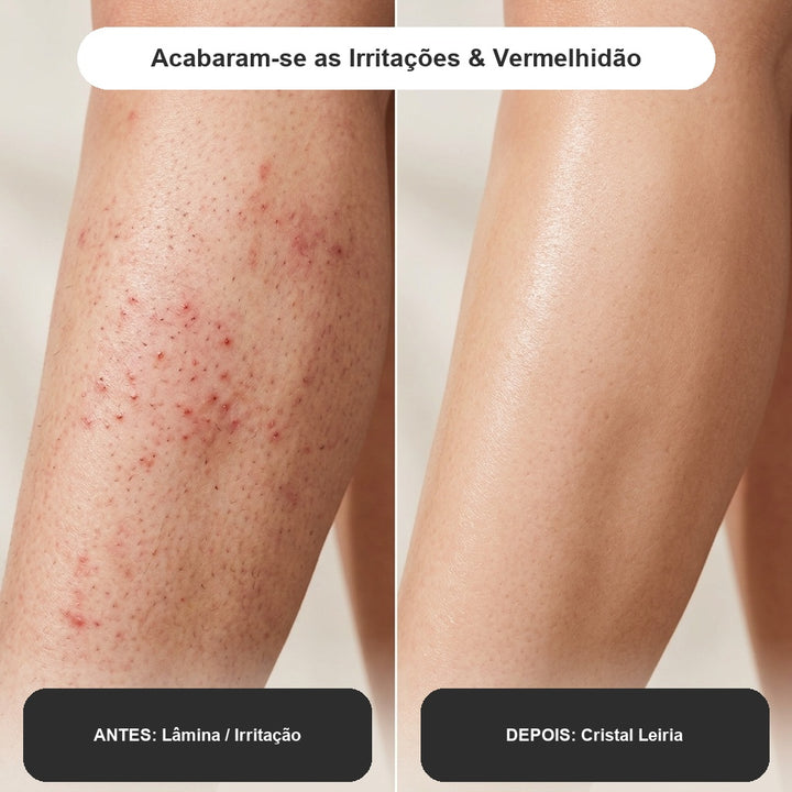 Ema | Aparador íntimo e corporal de alta precisão